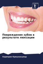 Powrezhdeniq zubow w rezul'tate lüxacii