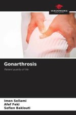 Gonarthrosis