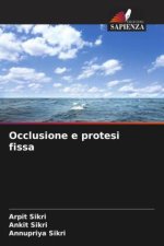 Occlusione e protesi fissa