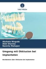 Umgang mit Okklusion bei Implantaten
