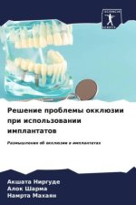 Reshenie problemy okklüzii pri ispol'zowanii implantatow