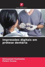 Impress?es digitais em prótese dentária