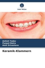 Keramik-Klammern