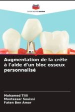 Augmentation de la crête à l'aide d'un bloc osseux personnalisé