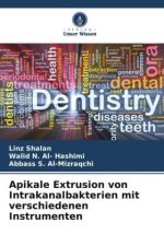 Apikale Extrusion von Intrakanalbakterien mit verschiedenen Instrumenten