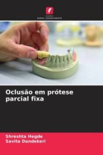 Oclusão em prótese parcial fixa