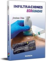 INFILTRACIONES ECOGUIADAS