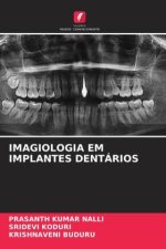 IMAGIOLOGIA EM IMPLANTES DENTÁRIOS
