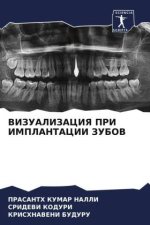 VIZUALIZACIYa PRI IMPLANTACII ZUBOV
