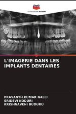 L'IMAGERIE DANS LES IMPLANTS DENTAIRES