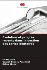 Evolution et progrès récents dans la gestion des caries dentaires