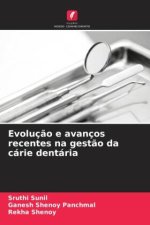 Evoluç?o e avanços recentes na gest?o da cárie dentária