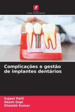 Complicaç?es e gest?o de implantes dentários
