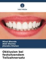 Okklusion bei festsitzendem Teilzahnersatz