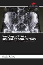 Imaging primary malignant bone tumors