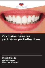 Occlusion dans les prothèses partielles fixes