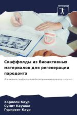 Skaffoldy iz bioaktiwnyh materialow dlq regeneracii parodonta
