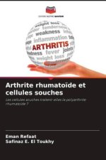Arthrite rhumatoïde et cellules souches