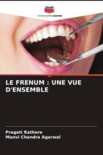 LE FRENUM : UNE VUE D'ENSEMBLE