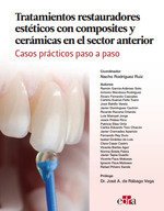 TRATAMIENTOS RESTAURADORES ESTETICOS CON COMPOSITES Y CERAMI