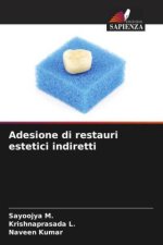 Adesione di restauri estetici indiretti