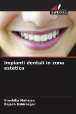 Impianti dentali in zona estetica