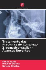 Tratamento das Fracturas do Complexo Zigomaticomaxilar - Avanços Recentes
