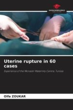 Uterine rupture in 60 cases