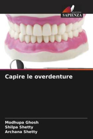 Capire le overdenture