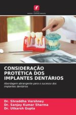 CONSIDERAÇ?O PROTÉTICA DOS IMPLANTES DENTÁRIOS