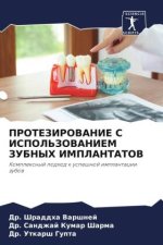 PROTEZIROVANIE S ISPOL'ZOVANIEM ZUBNYH IMPLANTATOV