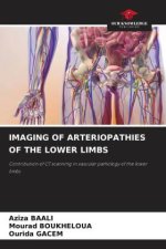 IMAGING OF ARTERIOPATHIES OF THE LOWER LIMBS