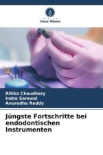 Jüngste Fortschritte bei endodontischen Instrumenten