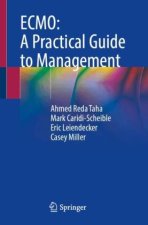 ECMO: A Practical Guide to Management