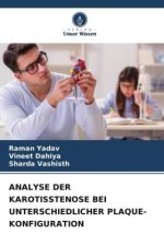 ANALYSE DER KAROTISSTENOSE BEI UNTERSCHIEDLICHER PLAQUE-KONFIGURATION