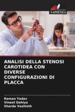 ANALISI DELLA STENOSI CAROTIDEA CON DIVERSE CONFIGURAZIONI DI PLACCA