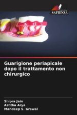 Guarigione periapicale dopo il trattamento non chirurgico
