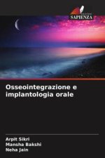 Osseointegrazione e implantologia orale