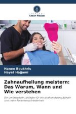 Zahnaufhellung meistern: Das Warum, Wann und Wie verstehen
