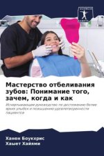 Masterstwo otbeliwaniq zubow: Ponimanie togo, zachem, kogda i kak