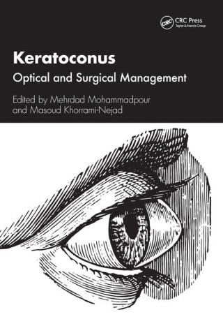 Keratoconus