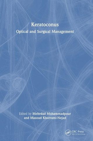Keratoconus
