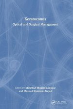 Keratoconus