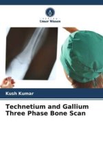 Technetium and Gallium Three Phase Bone Scan