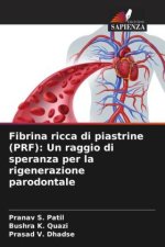 Fibrina ricca di piastrine (PRF): Un raggio di speranza per la rigenerazione parodontale