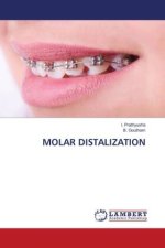 MOLAR DISTALIZATION