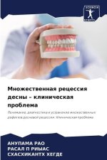 Mnozhestwennaq recessiq desny - klinicheskaq problema
