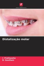Distalização molar