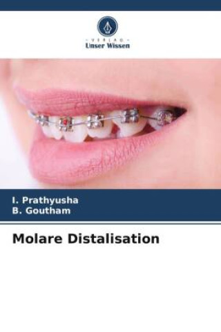 Molare Distalisation