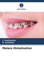 Molare Distalisation